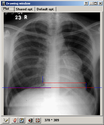 Image measure example